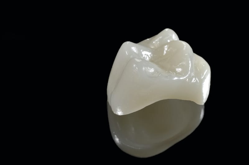 an isolated shot of a CEREC dental crown
